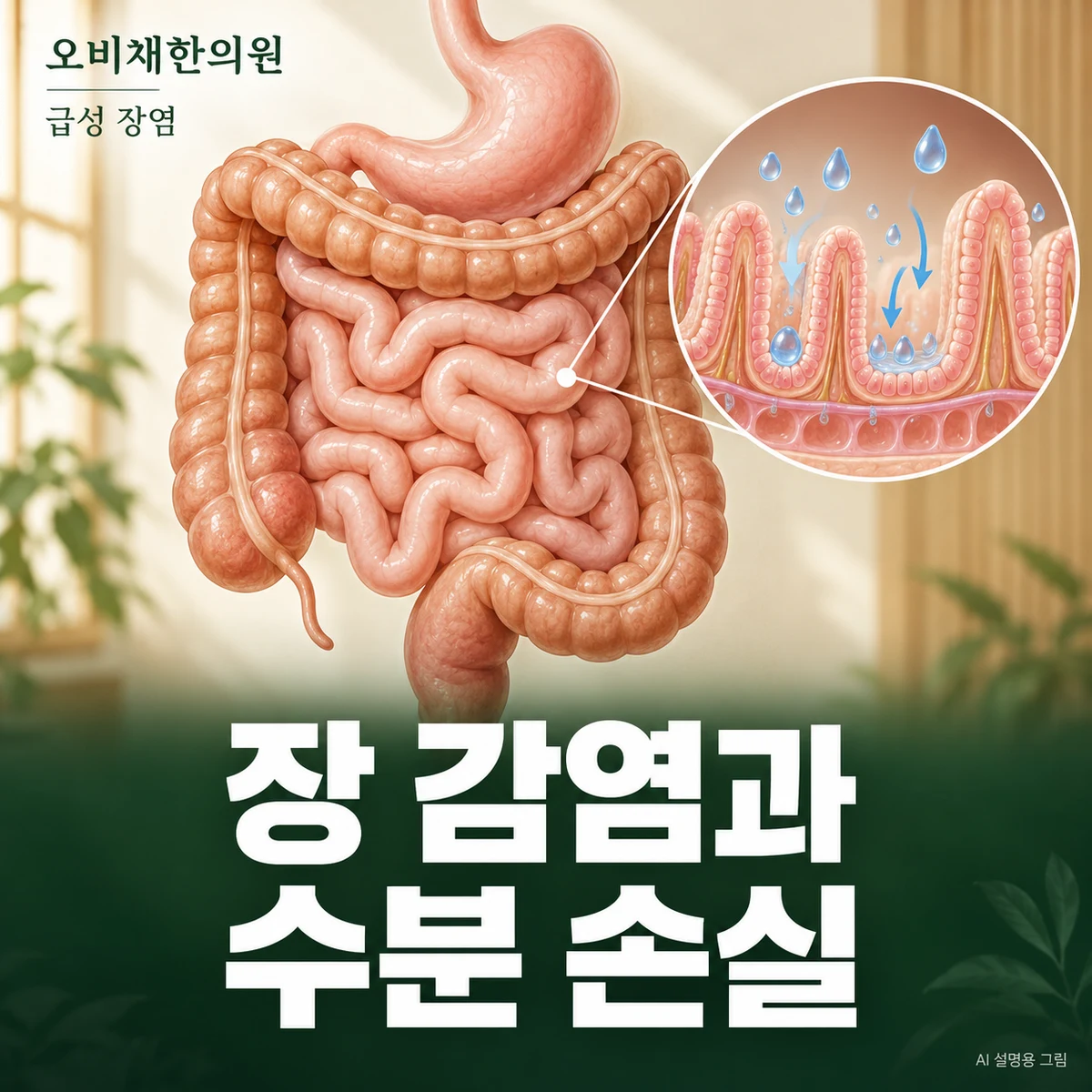 목동 급성 장염 원인과 구분 · 장 감염과 음식·접촉 이력