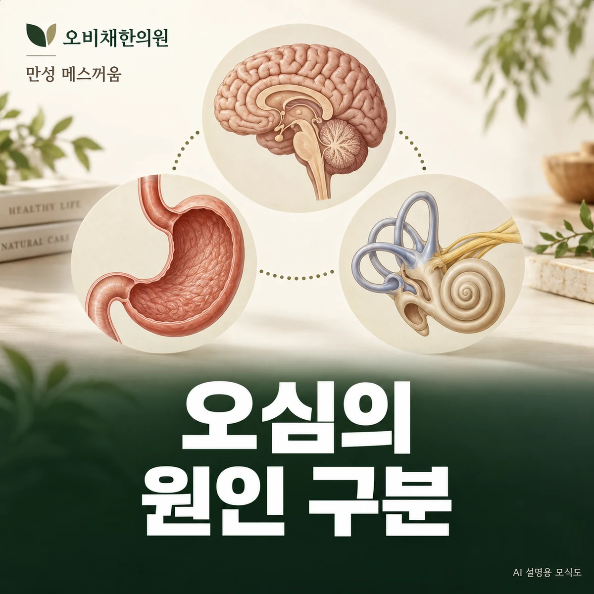 목동 만성 메스꺼움 원인과 구분 · 위장·약물·어지러움