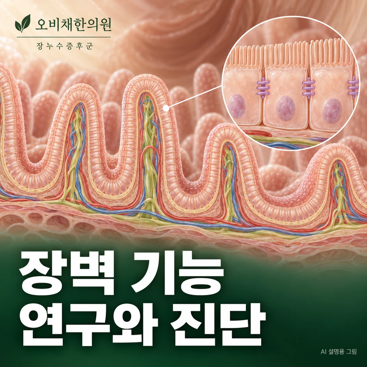 목동 장누수증후군 원인과 구분 · 장벽 기능과 연구의 범위