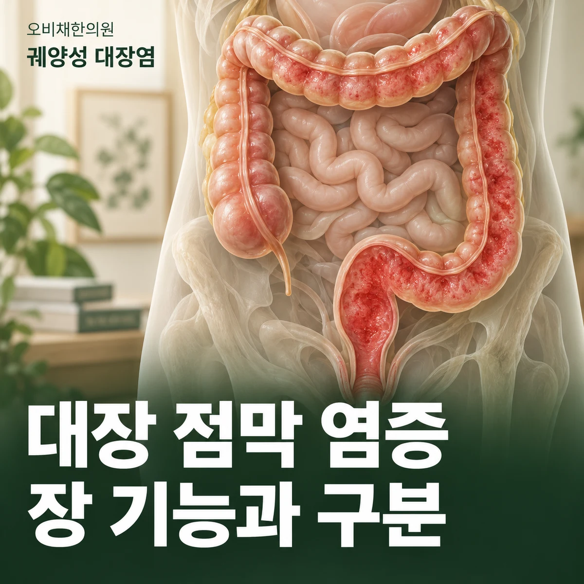목동 궤양성 대장염 원인과 구분 · 대장 염증과 장 기능