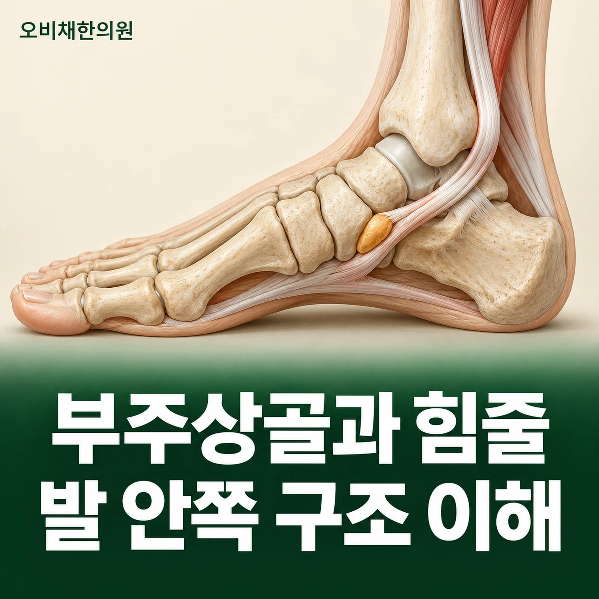 목동 부주상골증후군 원인과 구분 · 부주상골과 후경골건