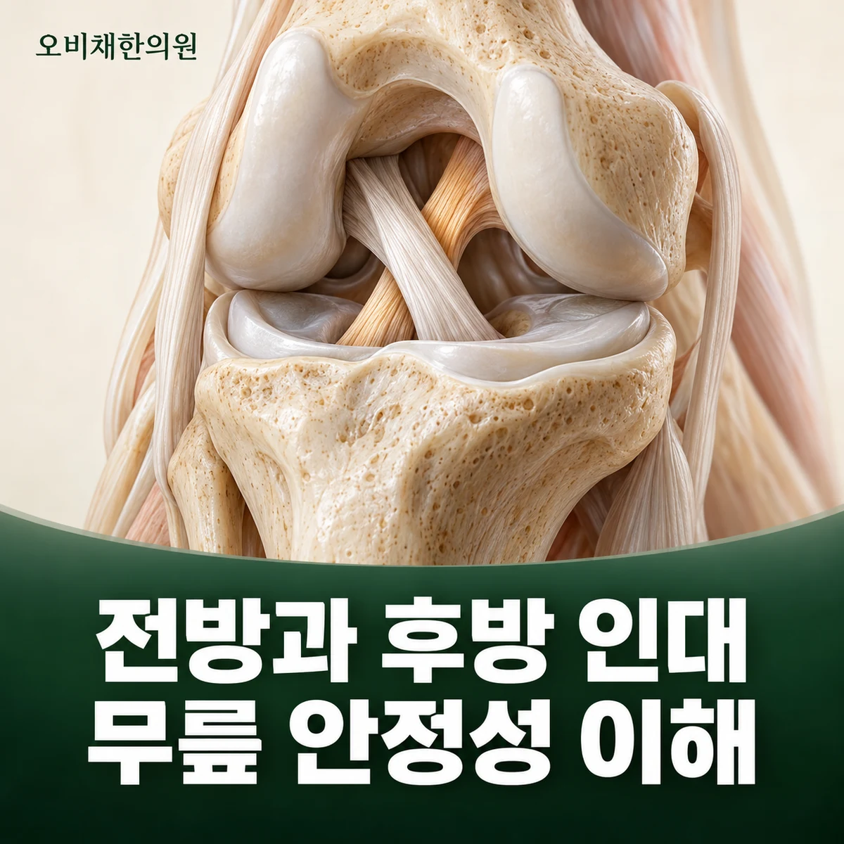목동 십자인대파열 원인과 구분 · 전방·후방 십자인대