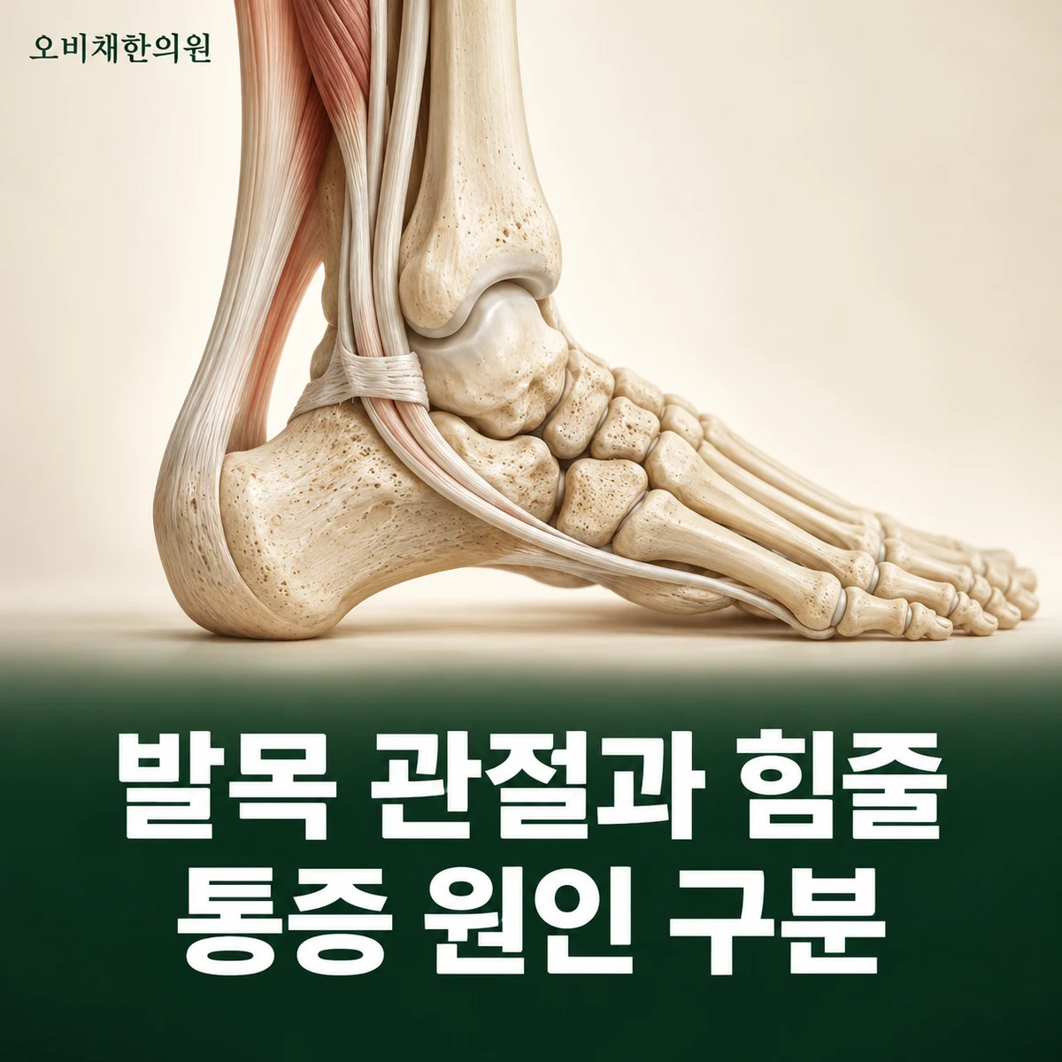 목동 발목통증 원인과 구분 · 관절과 주변 힘줄