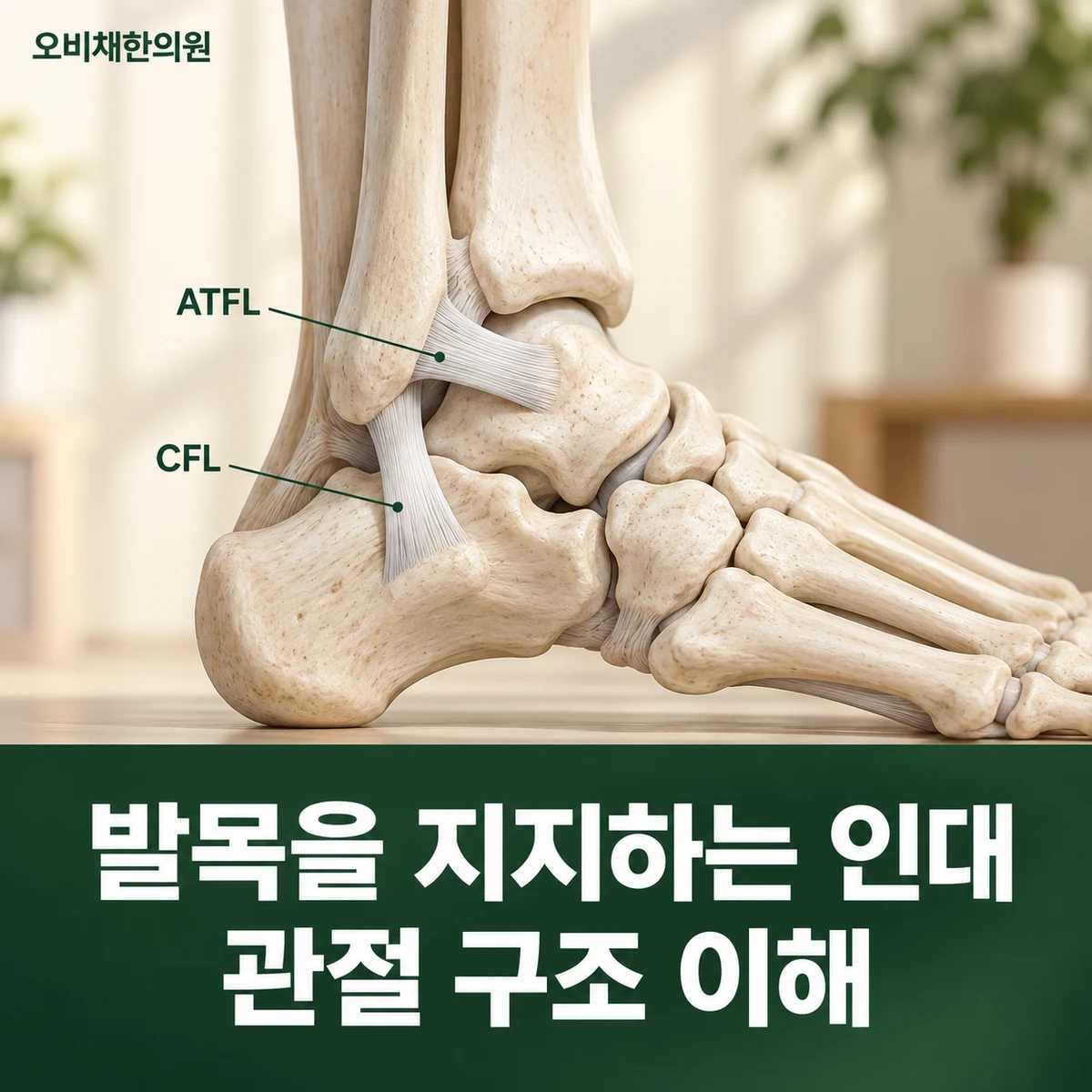 목동 발목염좌 원인과 구분 · 발목을 지지하는 인대 · 관절 구조 이해