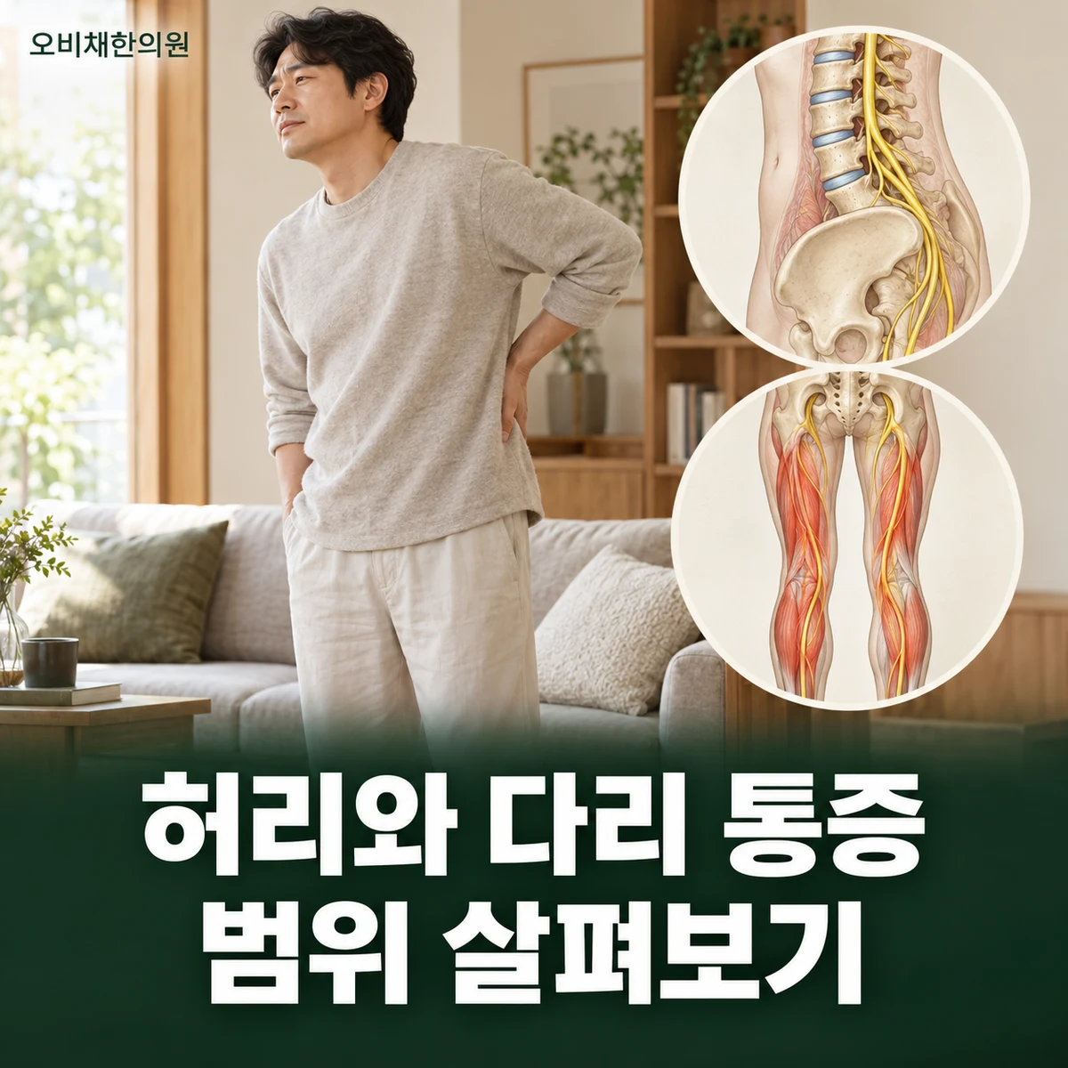 목동 허리디스크 증상 · 허리와 다리 통증의 범위