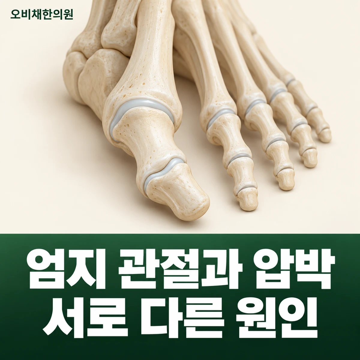 목동 엄지발가락통증 원인과 구분 · 관절과 압박 요인