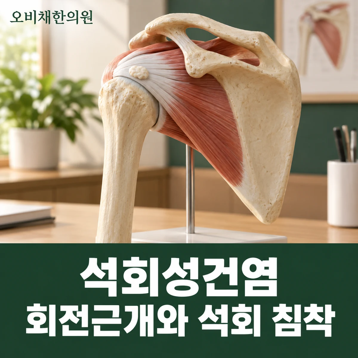 목동 석회성건염 원인과 구분 · 회전근개와 석회 침착