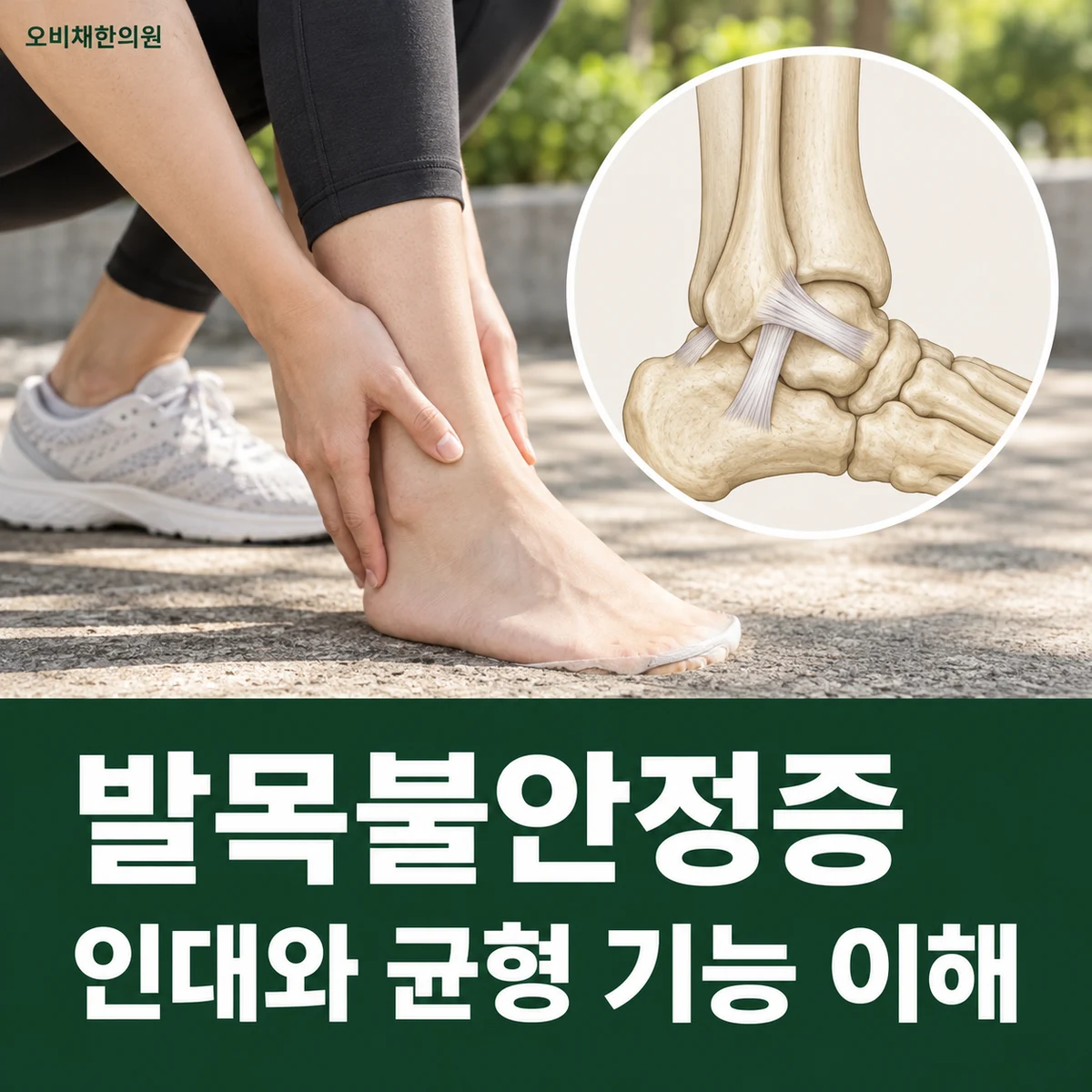목동 발목불안정증 원인과 구분 · 인대와 균형 기능 이해