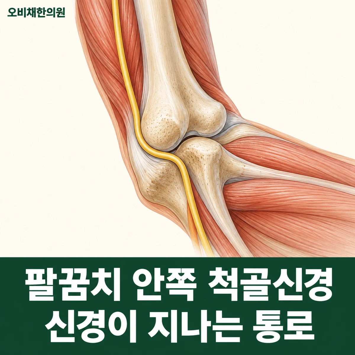 목동 주관증후군 원인과 구분 · 팔꿈치 안쪽 척골신경 통로