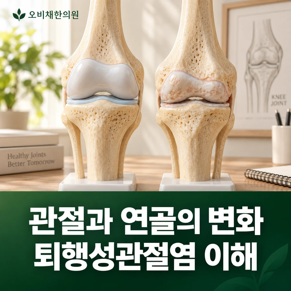 목동 퇴행성관절염 원인과 구분 · 관절과 연골의 변화 · 퇴행성관절염 이해