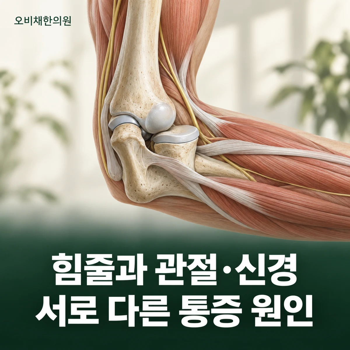 목동 팔꿈치통증 원인과 구분 · 힘줄·관절·신경 살피기