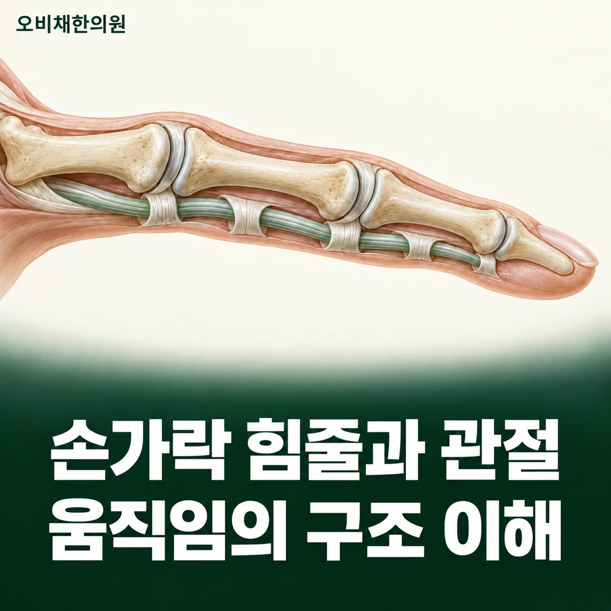 목동 손가락통증 원인과 구분 · 힘줄과 관절의 차이