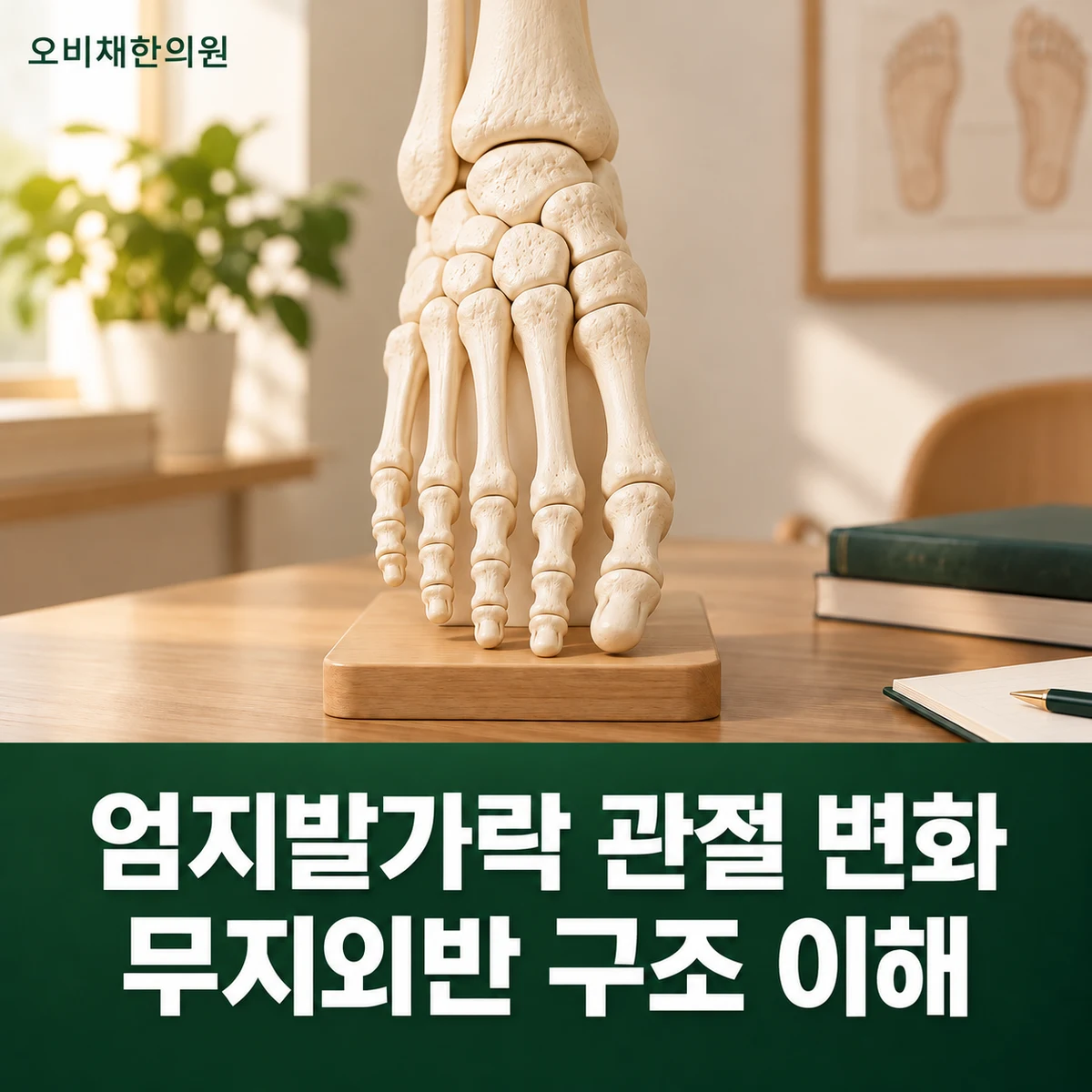 목동 무지외반증 원인과 구분 · 엄지발가락 관절 변화 · 무지외반 구조 이해