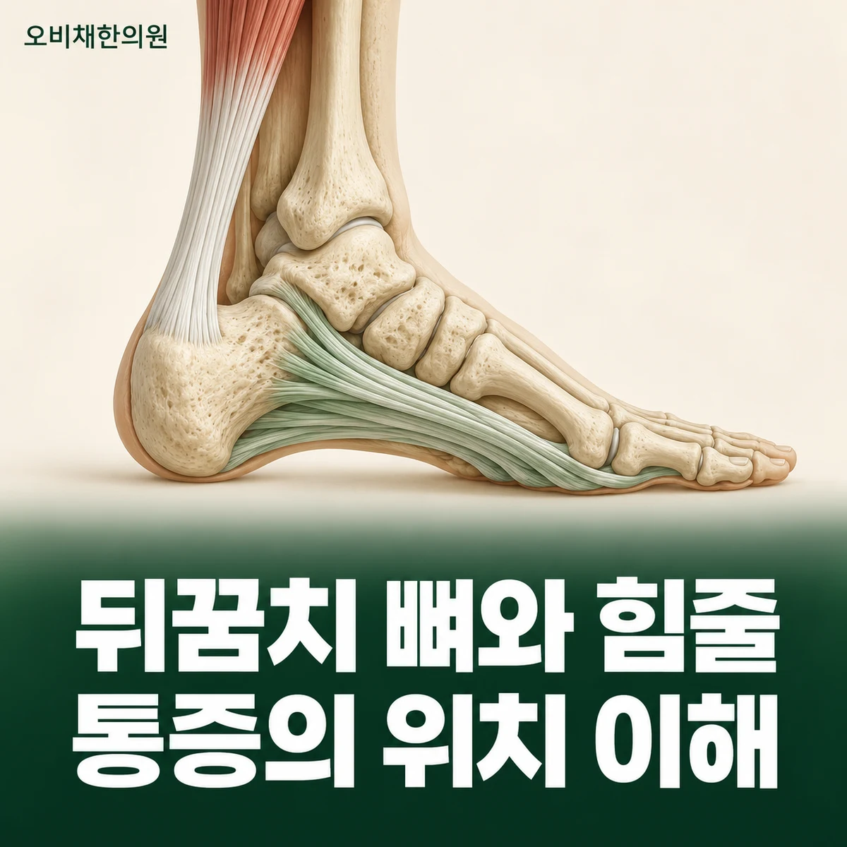 목동 뒤꿈치통증 원인과 구분 · 뒤꿈치 주변 구조