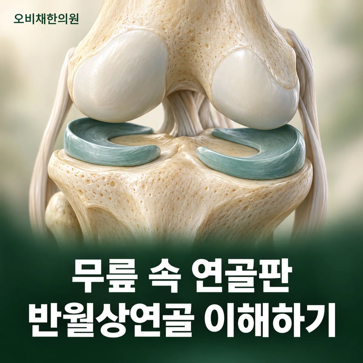 목동 반월상연골파열 원인과 구분 · 반월상연골의 역할
