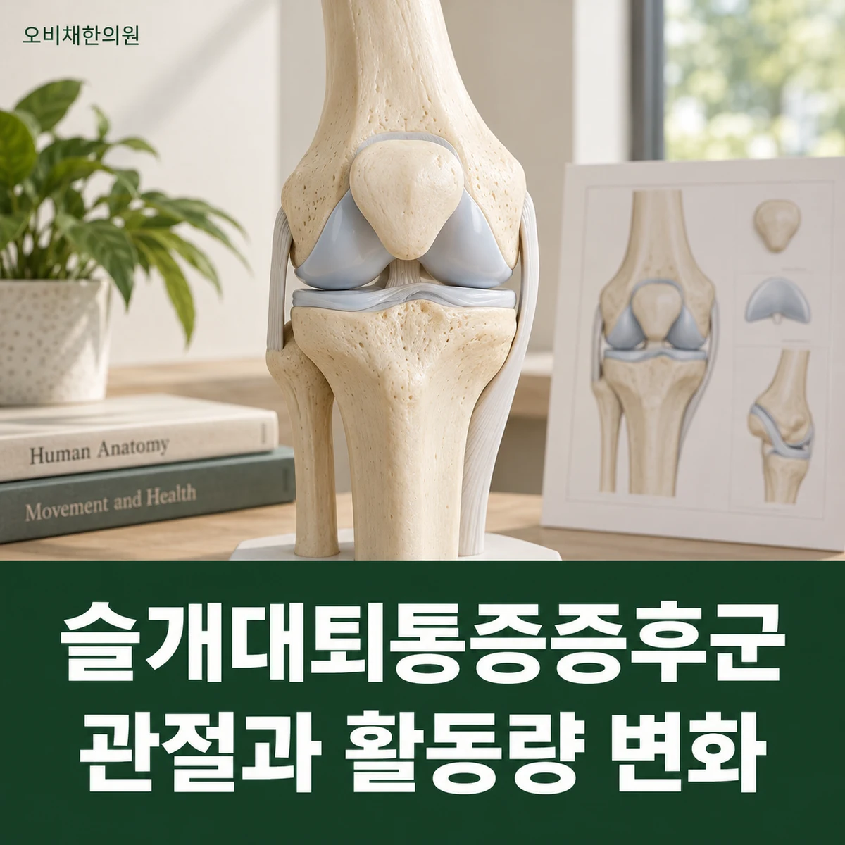 목동 슬개대퇴통증증후군 원인과 구분 · 관절과 활동량 변화