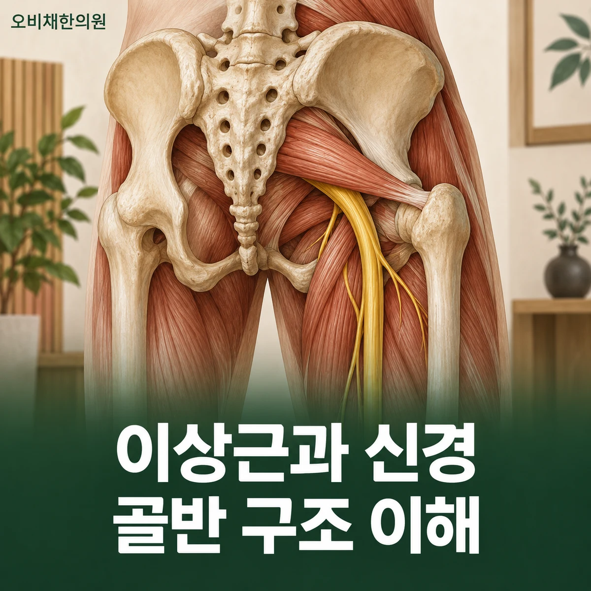 목동 이상근증후군 원인과 구분 · 이상근과 좌골신경
