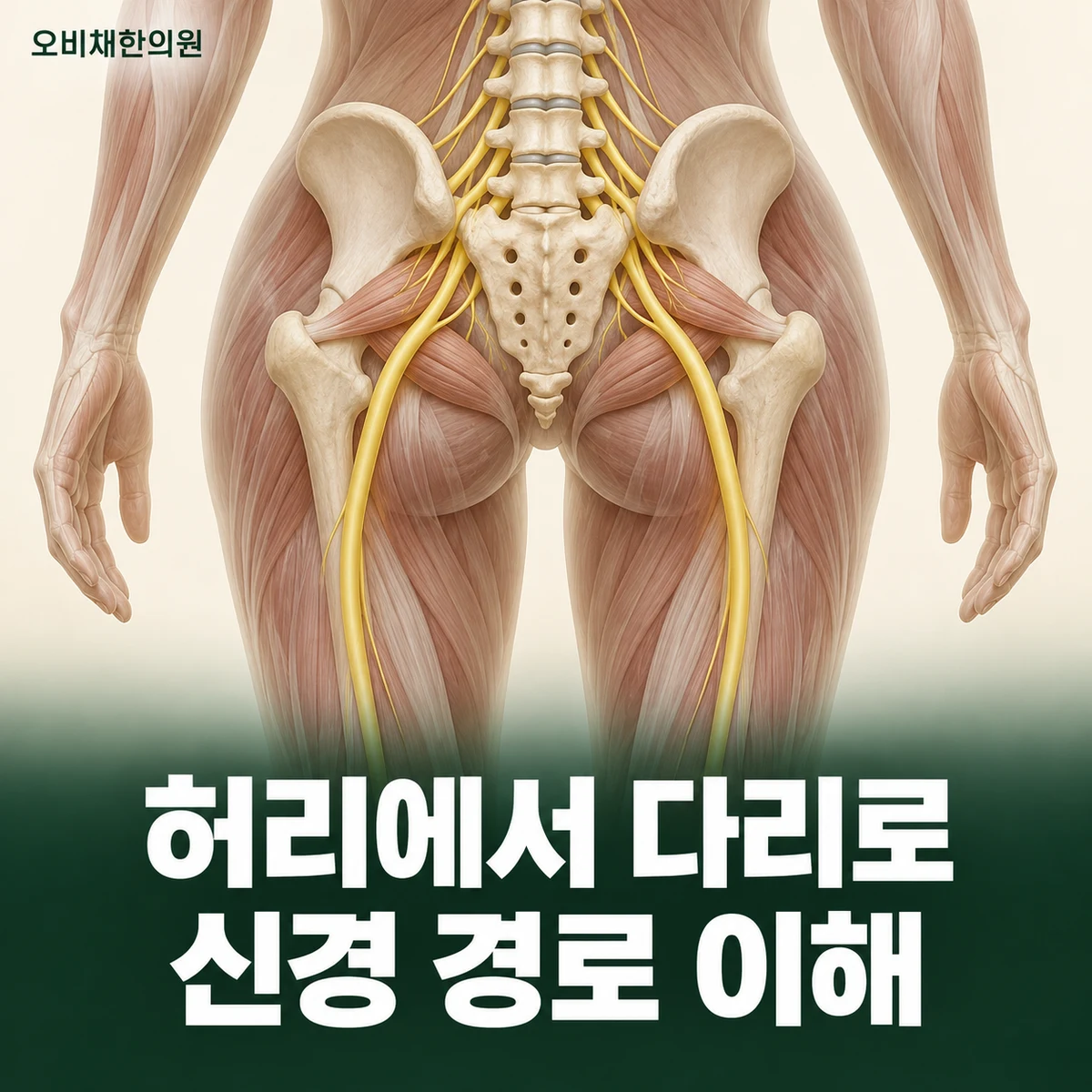 목동 좌골신경통 원인과 구분 · 신경의 경로와 원인