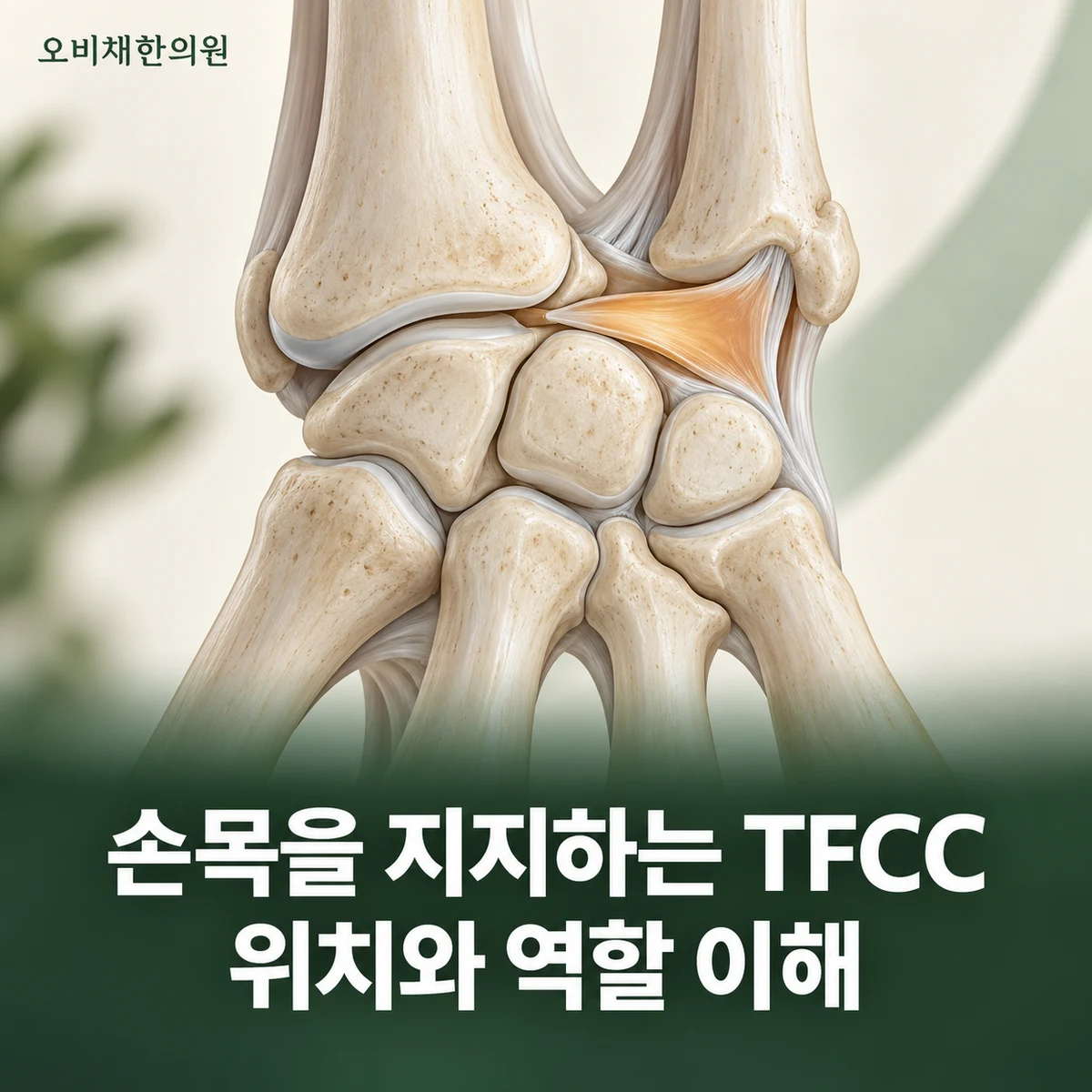 목동 TFCC손상 원인과 구분 · TFCC와 손목 안정성