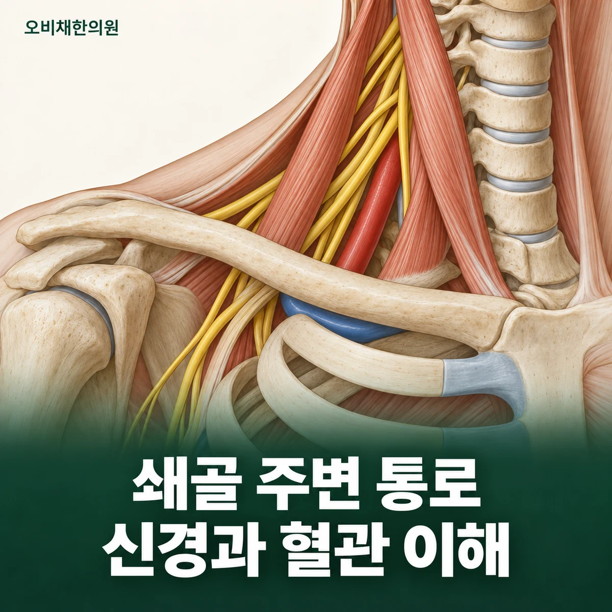 목동 흉곽출구증후군 원인과 구분 · 신경과 혈관의 통로