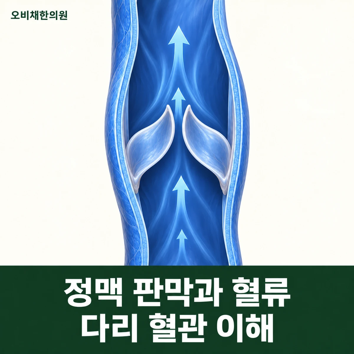 목동 하지정맥류다리통증 원인과 구분 · 정맥 판막과 혈류
